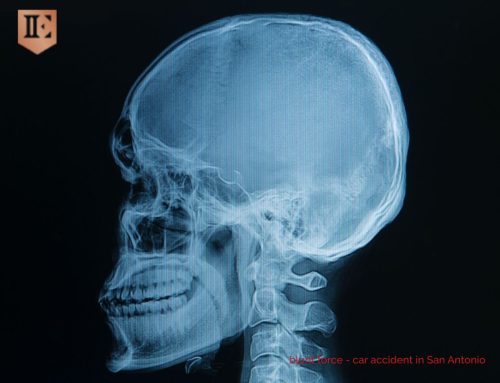 blunt force trauma to the head from car accident